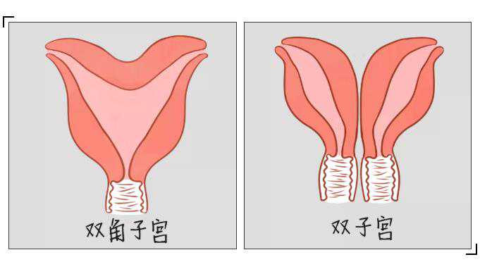 广州供卵试管包生男孩的助孕流程,广州助孕机构有哪些？广州十月幸孕生殖中