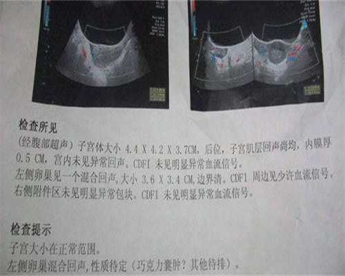男性不孕检查项目