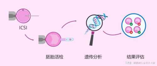 精索静脉彩超不育