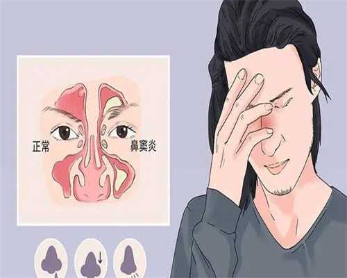 早泄不育