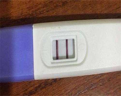 看不孕不育哪家医院好
